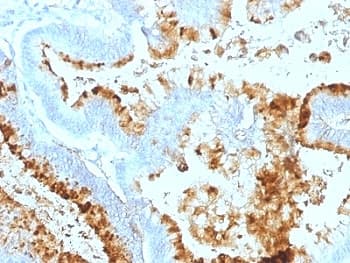 Lewis A Blood Group Antigen Antibody (clone 7LE, Ready-to-Use)