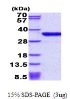 Human DKK1 Protein (Recombinant His)