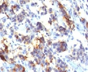 MUC5AC Antibody (clone MUCN5AC)