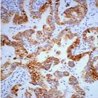 PathPlus™ Monoclonal Mouse anti-Human KRT7 / CK7 / Cytokeratin 7 Antibody (IHC, WB)