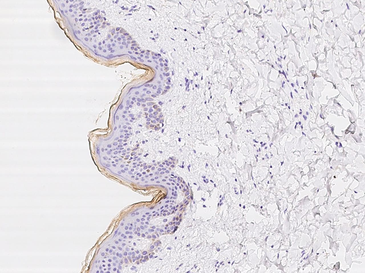 C1orf68 / XP32 Antibody