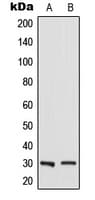 RAB23 Antibody (Internal)