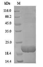 Cow CD8A / CD8 Alpha Protein (Recombinant 6His, N-terminus)