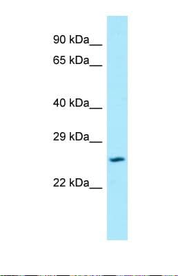 SLC17A1 / VGLUT1 Antibody (aa26-75)