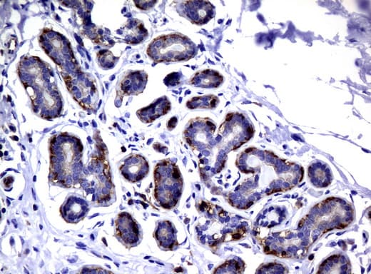 DEF6 Antibody (clone UMAB51)
