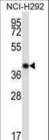 SYT2 Antibody (aa243-272)