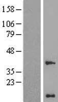 WBP5 Protein (Over-Expression Lysate Myc-DDK (Flag))