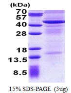 Human IL13RA2 / IL13R Alpha 2 Protein (Recombinant His)