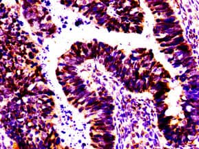 Polyclonal Rabbit anti-Human MSX2 / MSH Antibody (IHC, WB)