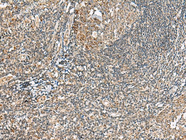 MOB2 Antibody