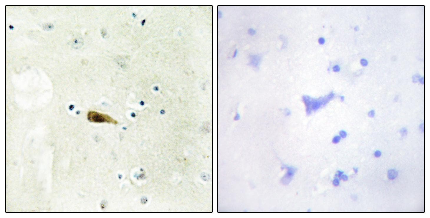 MYST1 Antibody