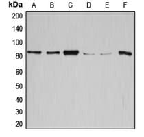 GYS1 / Glycogen Synthase Antibody (C-Terminus)