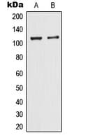 Polyclonal Rabbit anti-Human TRIM24 / TIF1 Antibody (C-Terminus, IHC, WB)
