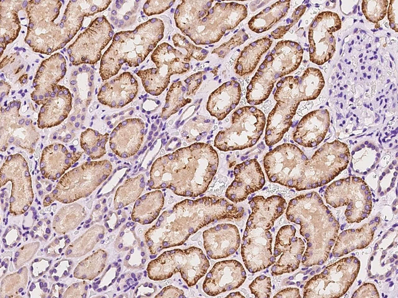 SLC22A8 / OAT3 Antibody
