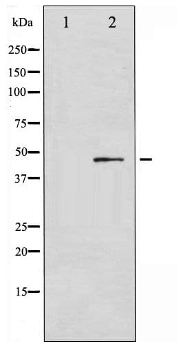 SMAD3 Antibody (phospho-Ser213)
