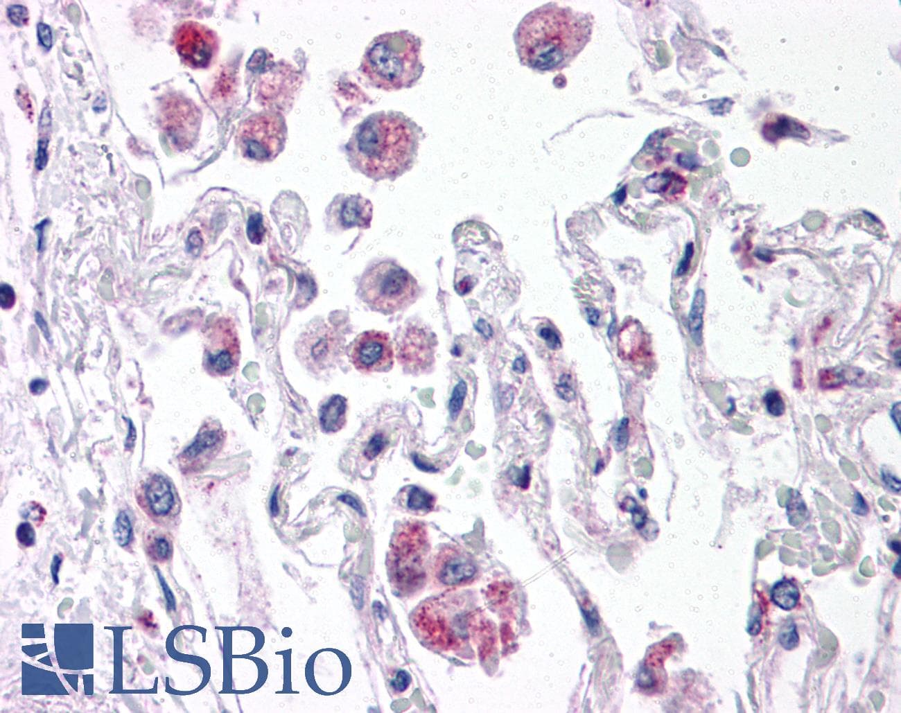 IHC-plus™ TLR8 Antibody