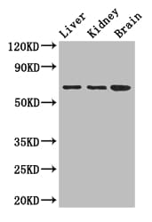 Polyclonal Rabbit anti-Human AK5 / Adenylate Kinase 5 Antibody (IHC, IF, WB)