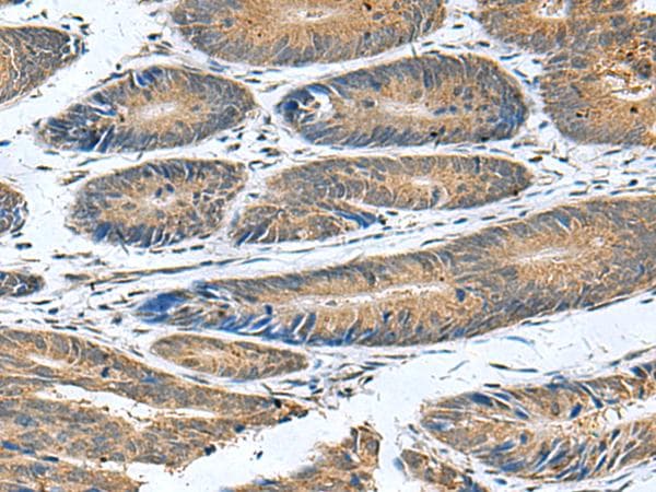 CLEC1B / CLEC-2 Antibody
