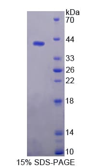 Mouse PLA2R / PLA2R1 Protein (Recombinant His-GST-S)