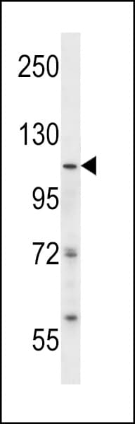 SMARCA5 / SNF2H Antibody (aa62-91)