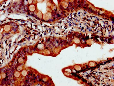 Polyclonal Rabbit anti-Human PDCD10 Antibody (aa1-212)