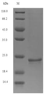 Mouse Osteocalcin Protein (Recombinant 6His-SUMO, N-terminus)