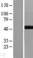 GALT Protein (Over-Expression Lysate Myc-DDK (Flag))
