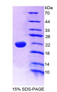 Mouse IL22 Protein (Recombinant His-T7)