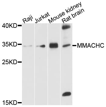 Polyclonal Rabbit anti-Human MMACHC Antibody (WB)