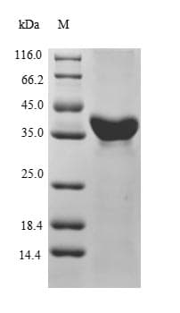 Mouse PON1 / ESA Protein (Recombinant)