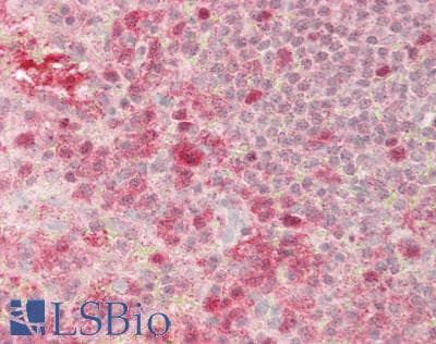 IHC-plus™ Polyclonal Rabbit anti-Human HK3 / Hexokinase 3 Antibody (IHC, WB)