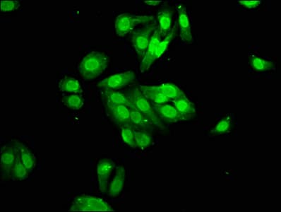 PYGO2 / Pygopus 2 Antibody