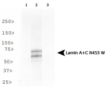LMNA / Lamin A+C Antibody (clone 12A-2F5)
