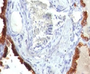 KRT7 / CK7 / Cytokeratin 7 Antibody (clone KRT7/760, Ready-to-Use)
