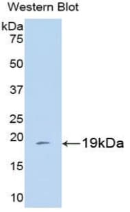 PPIA / Cyclophilin A Antibody (aa2-165, APC)