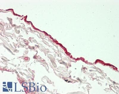 IHC-plus™ MSLN / Mesothelin Antibody (aa 37-598)