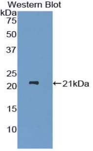 ADAMTS12 Antibody (aa823-997)