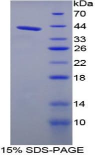 Mouse NPPC Protein (Recombinant His-GST)