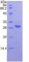 Rat IL-22BP / IL22RA2 Protein (Recombinant 6His, N-terminus)