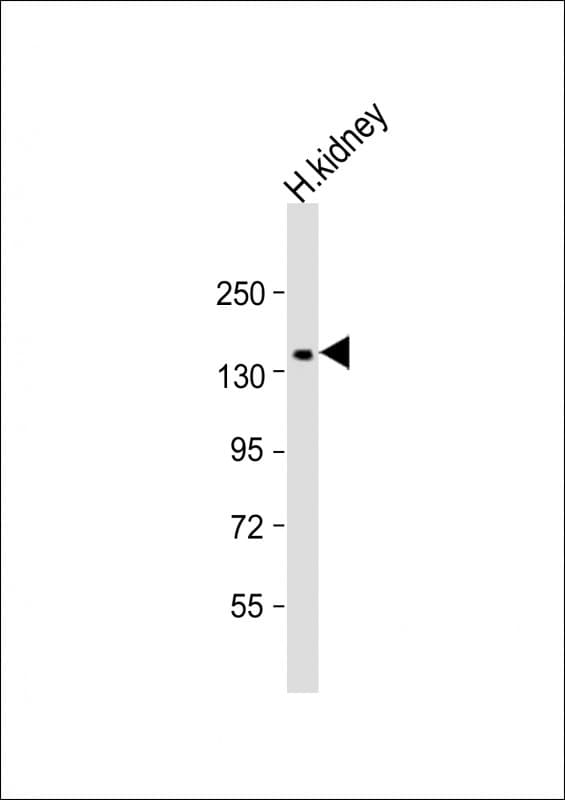COL4A3 / Tumstatin Antibody (aa141-173)
