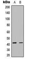 ACTA2 / Smooth Muscle Actin Antibody (N-Terminus)
