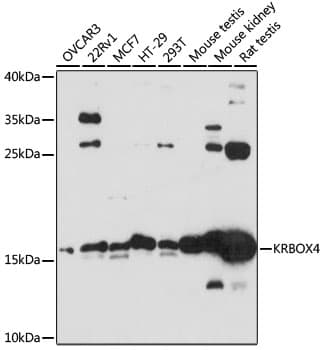 Polyclonal Rabbit anti-Human ZNF673 Antibody (WB)
