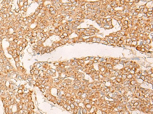 Polyclonal Rabbit anti-Human KRT9 / CK9 / Cytokeratin 9 Antibody (IHC)