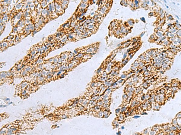 P5CR2 / PYCR2 Antibody