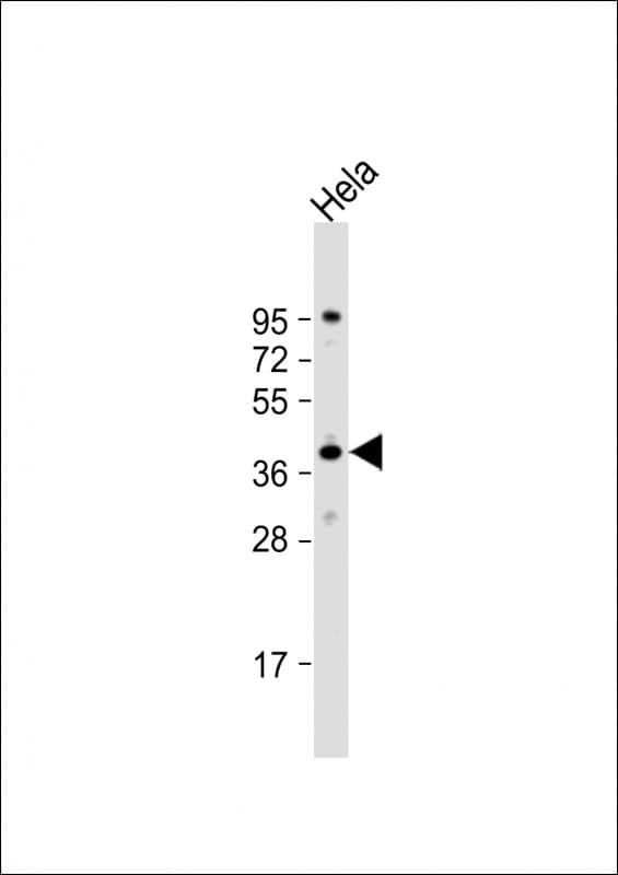 Polyclonal Rabbit anti-Human DNAJB4 Antibody (aa216-248, WB)