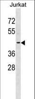 KCNAB3 Antibody (aa176-204)
