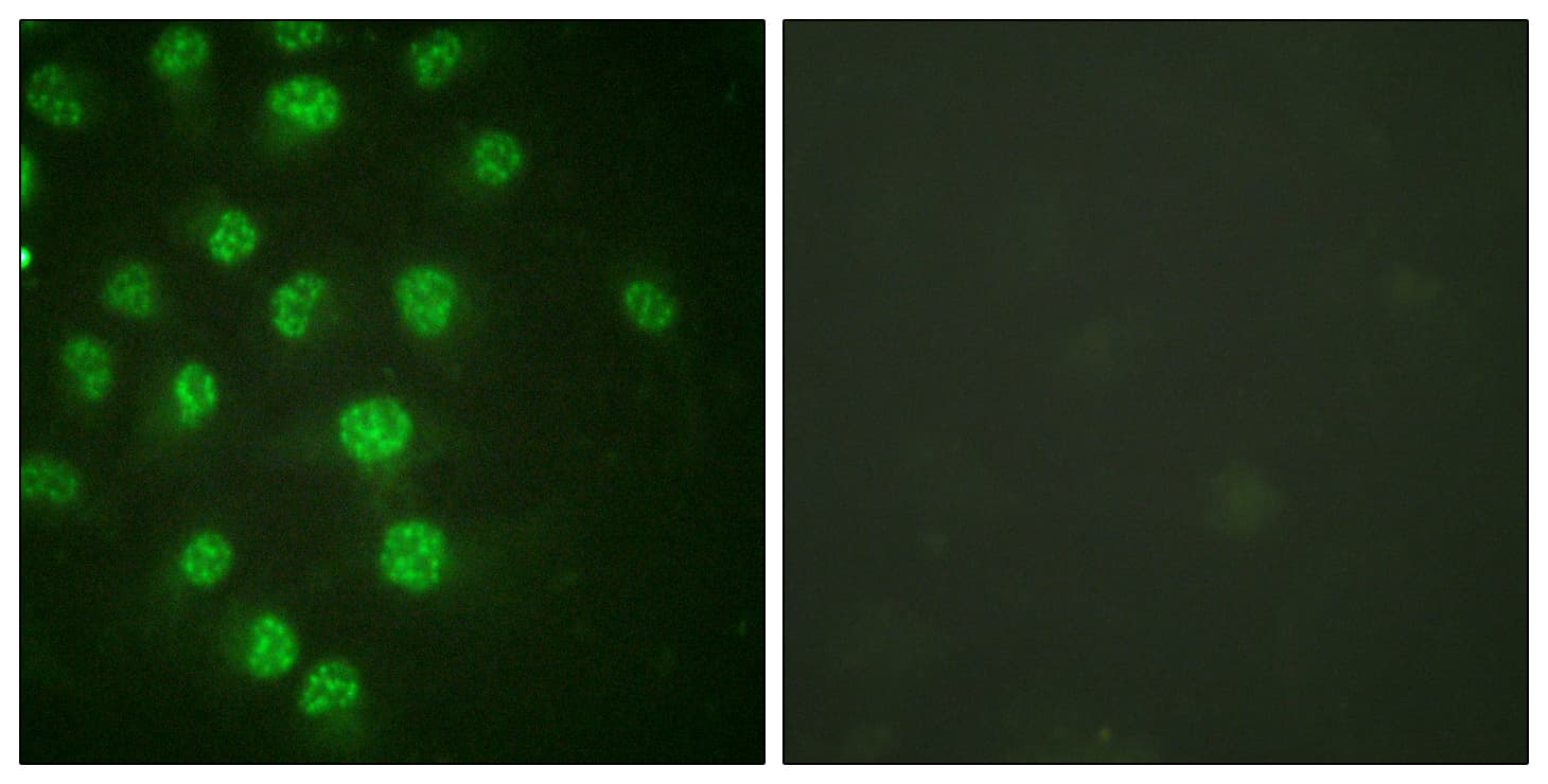 Polyclonal Rabbit anti-Human CDKN1C / p57 Kip2 Antibody (phospho-Thr310, IHC, IF, WB)