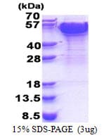Human Dynactin 2 / Dynamitin Protein (Recombinant His)