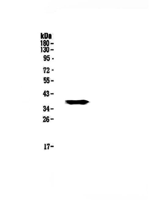 GALE / UDP-Glucose 4-Epimerase Antibody