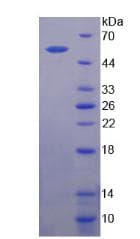 Human MRC2 / Endo180 Protein (Recombinant His-T7)